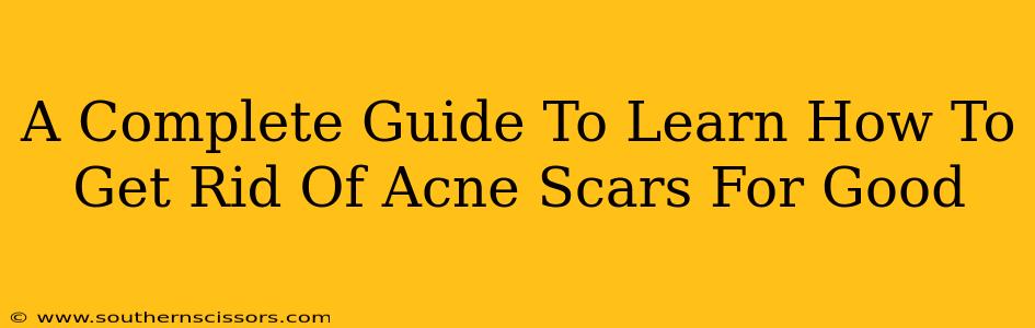 A Complete Guide To Learn How To Get Rid Of Acne Scars For Good